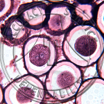 Ascaris Megalocephala Mitosis Prepared Microscope Slide