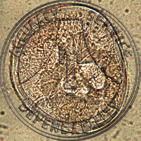 fasciola hepatica slide